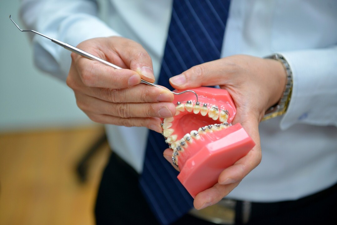 前两个星期出现口腔溃疡是正常的,原因在于这是传统托槽的固有缺陷