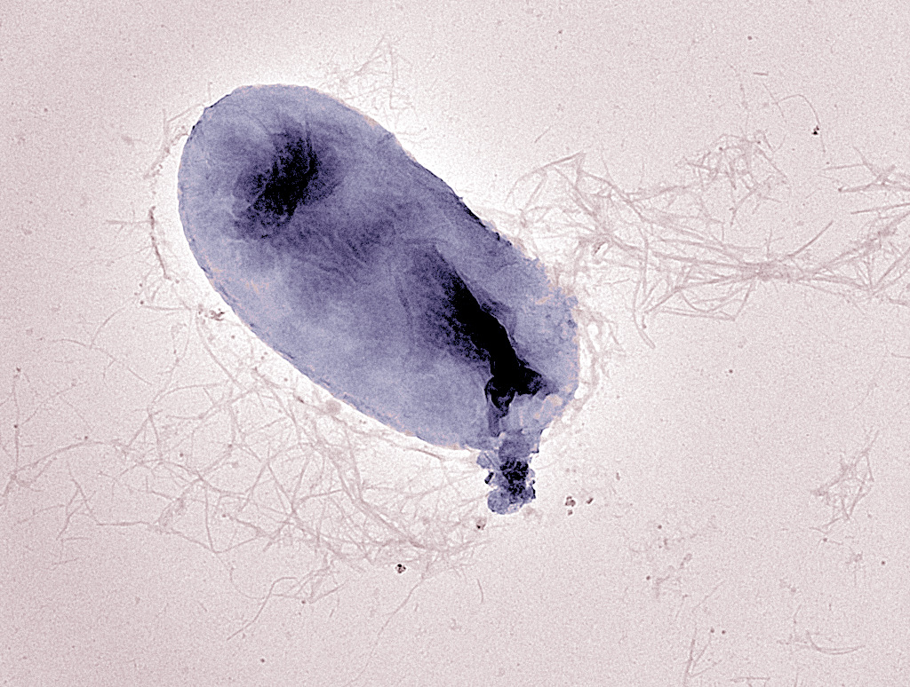细菌、电子显微镜、克雷伯杆菌肺炎 - 免费可商用图片 - CC0素材网